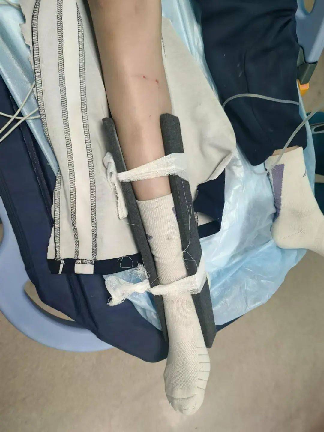 惨痛<strong></p>
<p>注意力币虚拟</strong>！一人身亡！深圳多名学生骑电动车发生意外