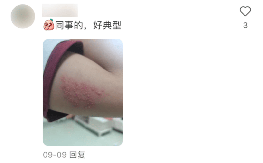 一旦感染终身携带<strong></p>
<p>网络虚拟币的分析</strong>！深圳疾控提醒：这4类人要注意