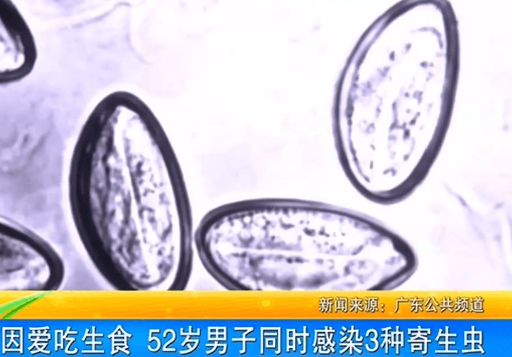 女子体内排出10米长绦虫<strong></p>
<p>虚拟币是怎么发行</strong>！原是两年前旅游时吃了这种食物
