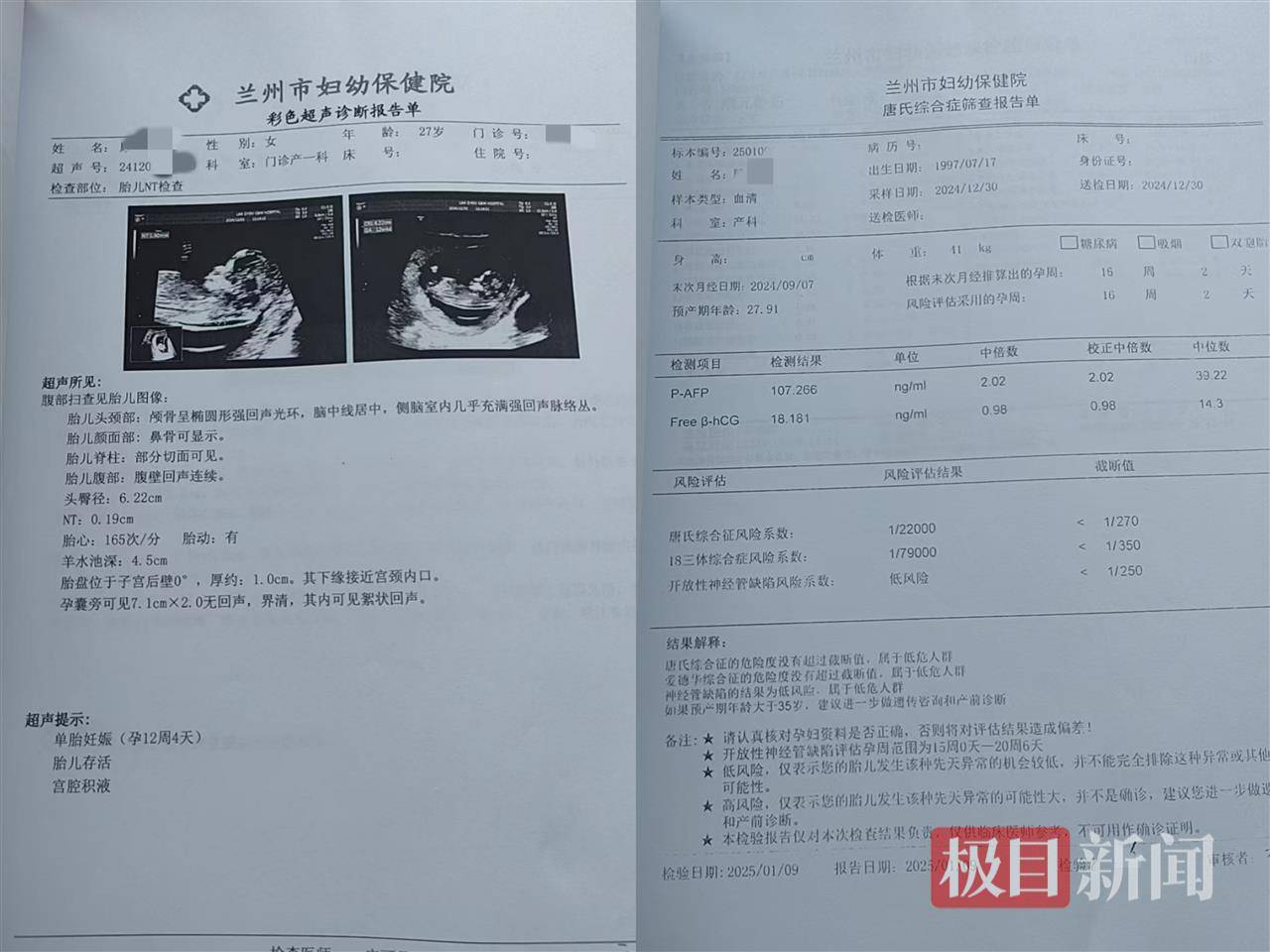 二胎出生查出先天性病症或落下残疾<strong></p>
<p>虚拟货币</strong>，残疾父母称医院产检漏检、未尽告知义务，医院及医调委回应