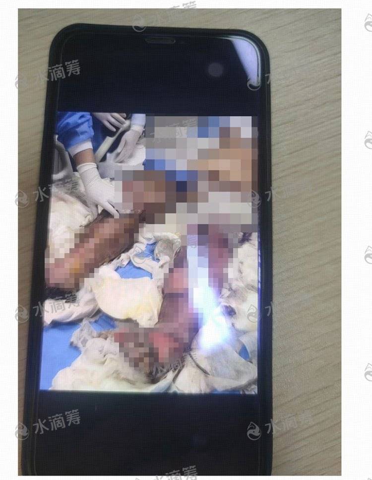 成都一小区电瓶车楼道“飞线充电”酿火灾<strong></p>
<p>hbar币</strong>，一家四口1死2伤，涉事车主被刑拘