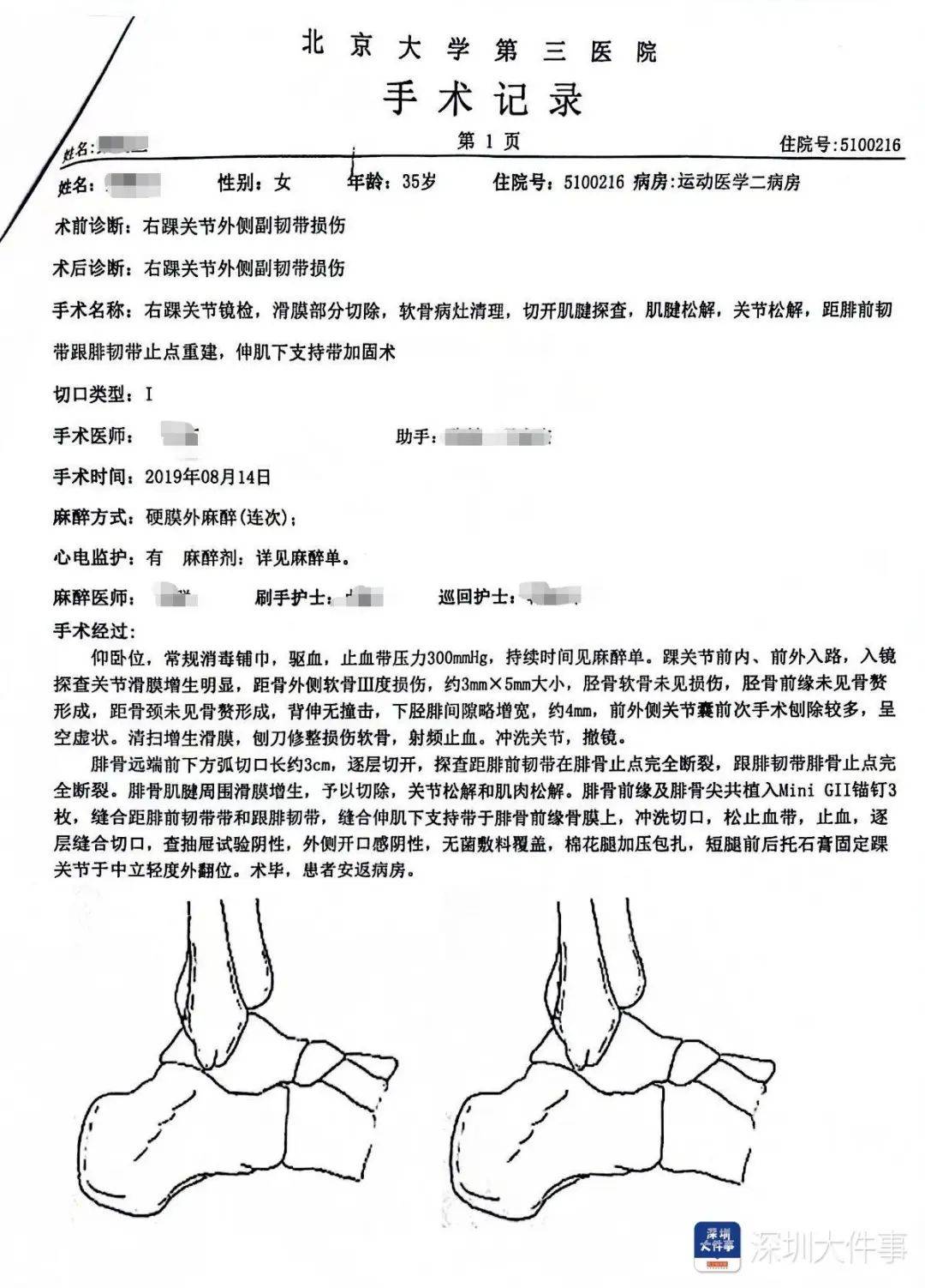 “一走路就痛”！女子脚踝受伤遭漏诊<strong></p>
<p>hbar币</strong>，治了7年没好！深圳一医院被告上法庭