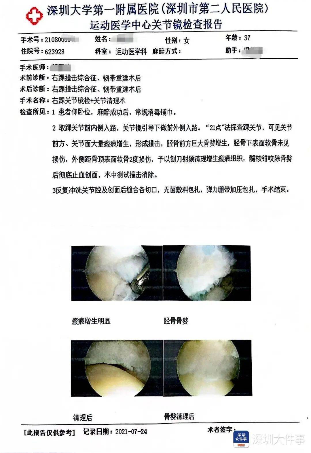 “一走路就痛”！女子脚踝受伤遭漏诊<strong></p>
<p>hbar币</strong>，治了7年没好！深圳一医院被告上法庭