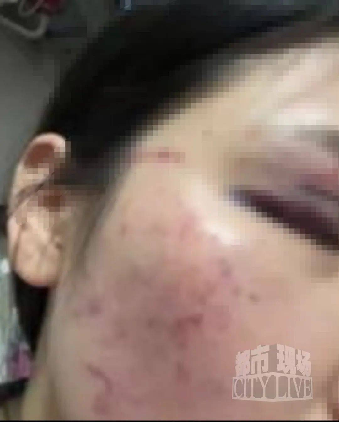 湖南衡阳29岁女子疑被男友施暴后从25楼跳下身亡 男友徐某此前还刺激说：“你放心<strong></p>
<p>行长</strong>，她不会去死的”