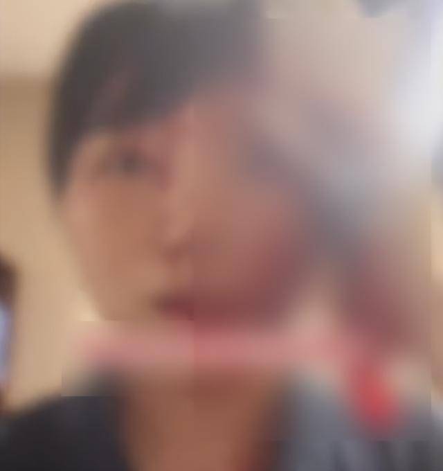 缝了20多针！女子称被不知名男同事砸头毁容<strong></p>
<p>海南航空股票</strong>，警方介入