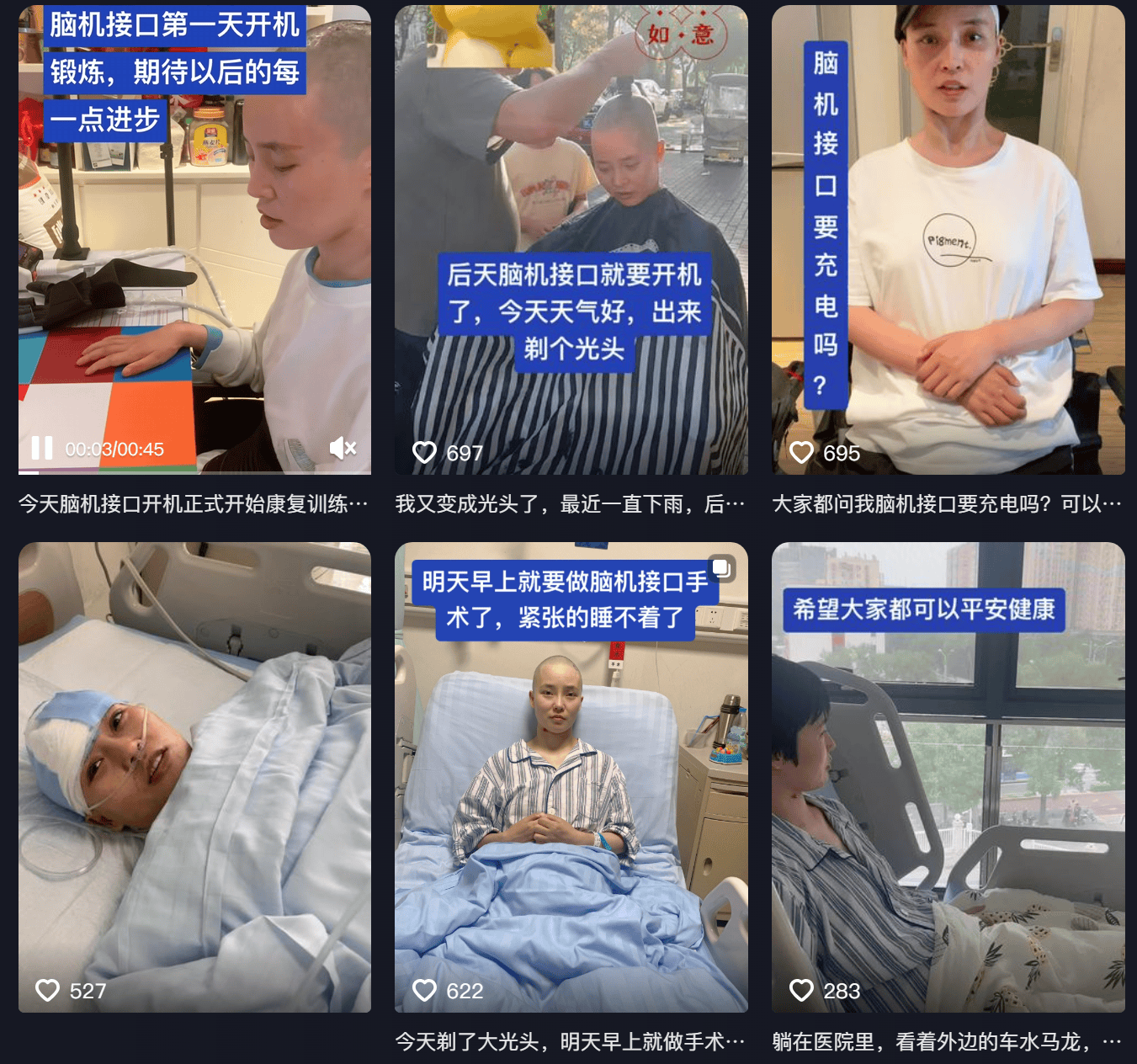 女子因车祸全身瘫痪6年仅嘴眼能动<strong></p>
<p>怡亚通股票</strong>，接受脑机接口手术后通过意念抓取物品！当事人讲述