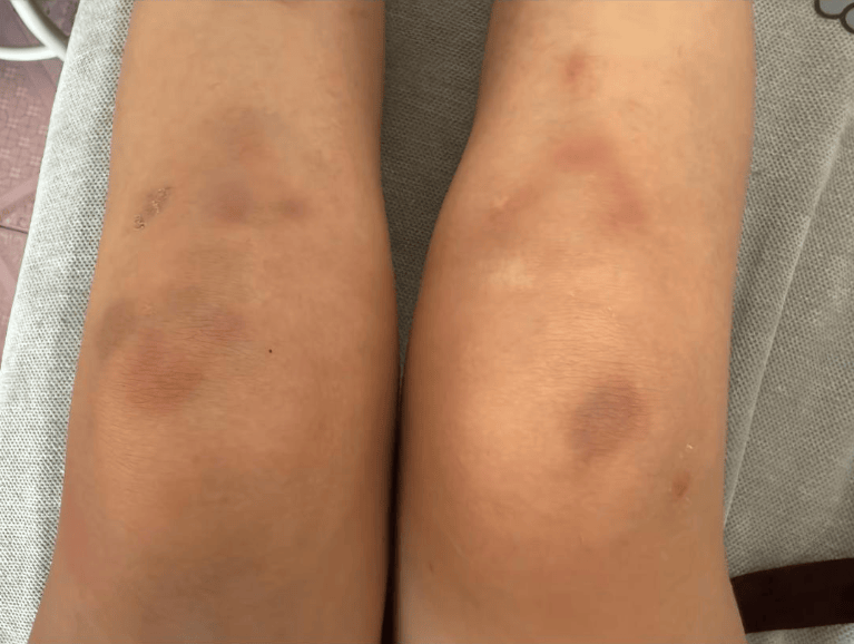 女子自称因工资问题被老板锁办公室里打 警方：双方已到派出所<strong></p>
<p>柳工股票</strong>，是否打人还在调查
