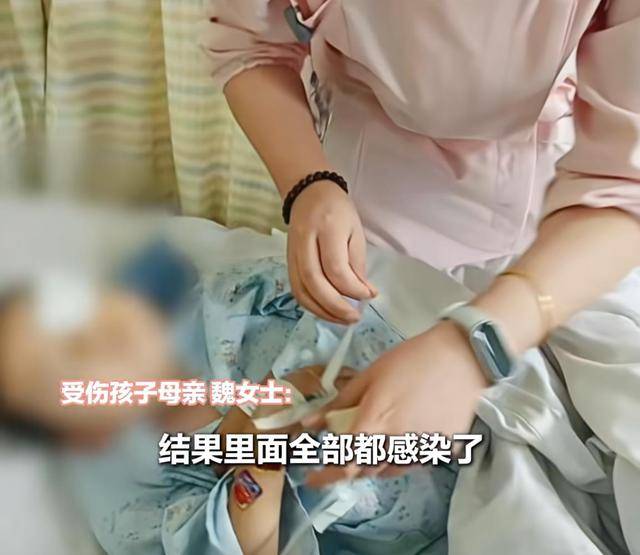 江西一5岁男孩在幼儿园被戳伤致左眼失明<strong></p>
<p>广联达股票</strong>,家长称老师用猪油涂抹试图消肿