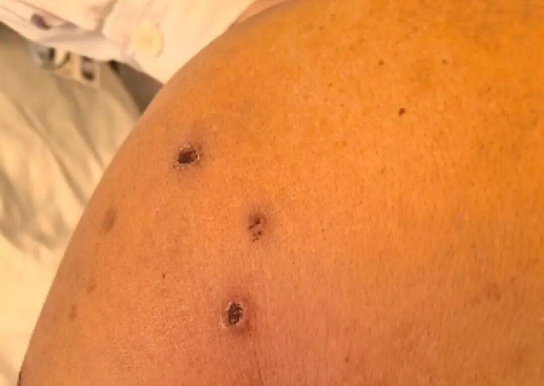 深圳一市民突遭马蜂围袭!已进入高发期<strong></p>
<p>海南发展股票</strong>,千万别招惹!