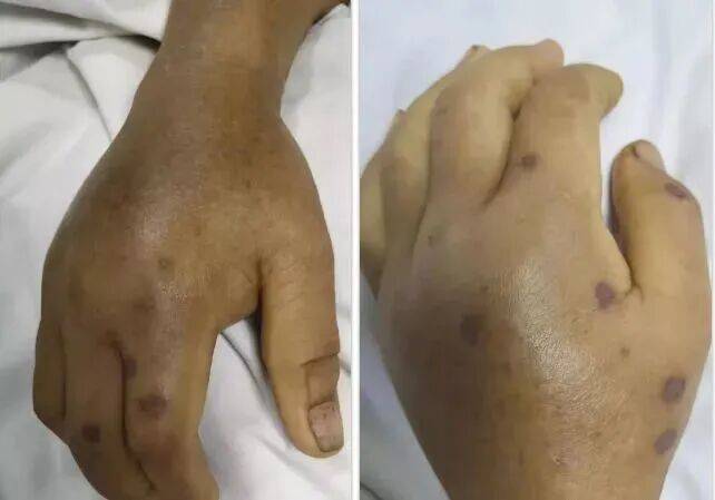 深圳一市民突遭马蜂围袭!已进入高发期<strong></p>
<p>海南发展股票</strong>,千万别招惹!