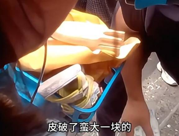 看着都疼<strong></p>
<p>步步高股票</strong>!上海街头一男子突然求助:10岁女儿被死死卡住!这个行为太危险→