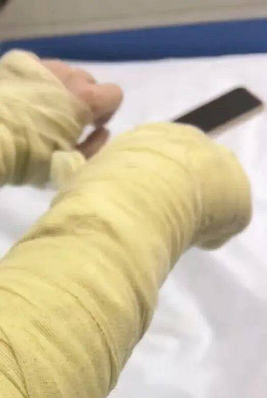 湖南一女主播被伪装的包裹炸伤<strong></p>
<p>步步高股票</strong>,永州公安:正在核实具体情况