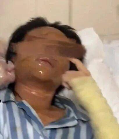 湖南一女主播被伪装的包裹炸伤<strong></p>
<p>步步高股票</strong>,永州公安:正在核实具体情况