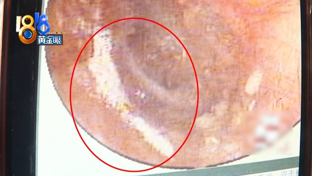 杭州姑娘痒了一整夜<strong></p>
<p>中国股票</strong>，检查结果让她崩溃……浴场回应索赔：凭什么要两千？