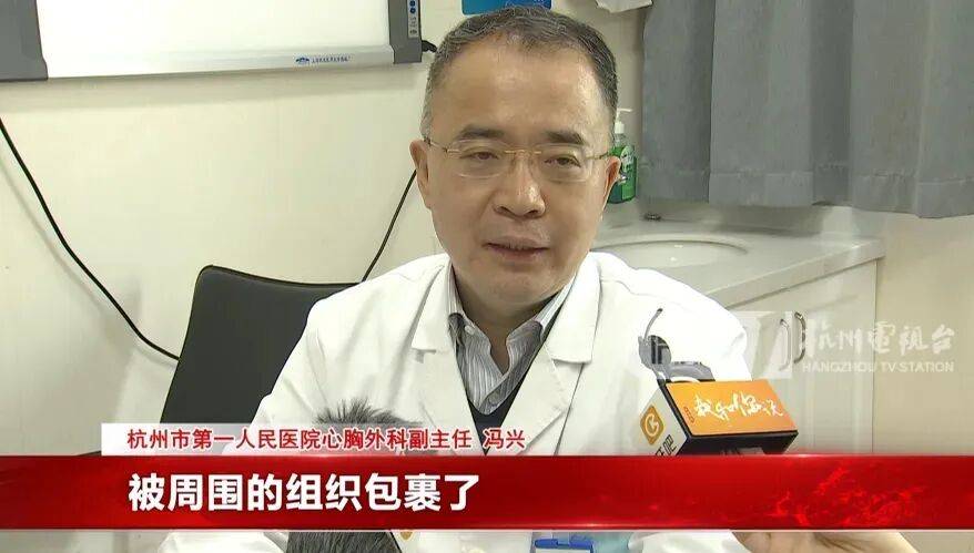 17岁小伙参军体检发现胸腔内有根5cm缝衣针<strong></p>
<p>双环传动股票</strong>，父母回忆或是1岁时扎入，取出时已锈迹斑斑